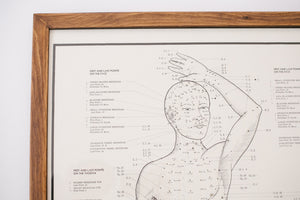 70s Acupuncture Chart